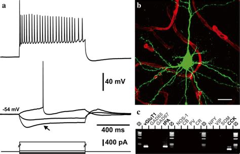 Electrophysiological, morphological, and molecular characterization of ... 