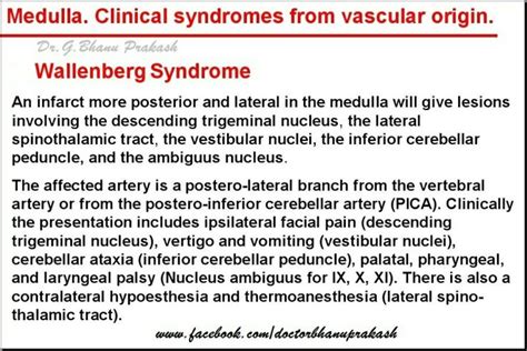 Wallenberg Syndrome | Spinothalamic tract, Vascular, Neurology