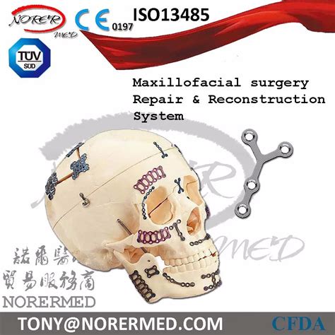 Cmf Titanium Maxillofacial Reconstruction System Maxillofacial Plate