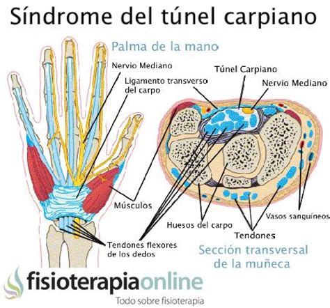 Sindrome Del T Nel Carp Ano Qu Es Causas S Ntomas Tratamiento Y