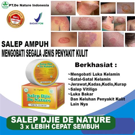 Jual Manjur Salep Djie De Nature Khusus Kutil Dalam Kelamin Gatal