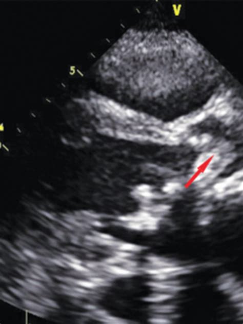 ECHO - Sahan Diagnostic Center