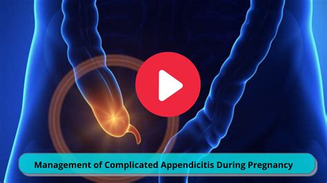 Management Of Complicated Appendicitis During Pregnancy Must