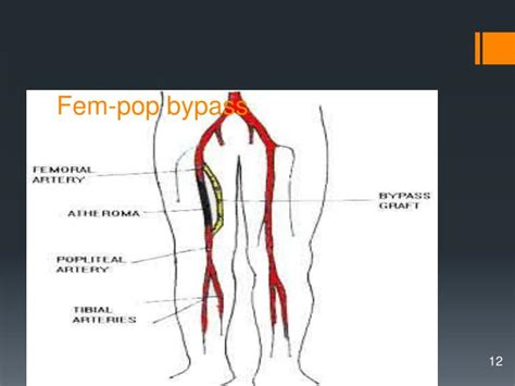 Ppt Vascular Powerpoint Presentation Id 1761434