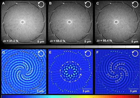 The Dynamics Of The Plasmonic Vortex