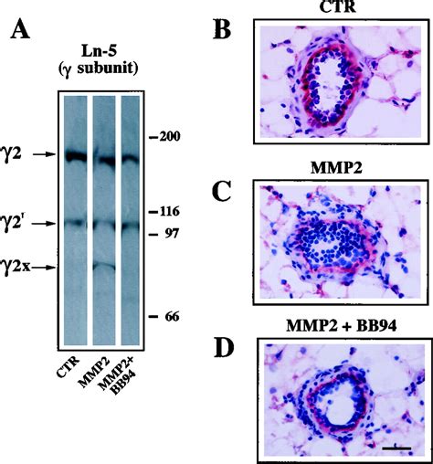 Expression Of Matrix Metalloprotease 2 Cleaved Laminin 5 In Breast