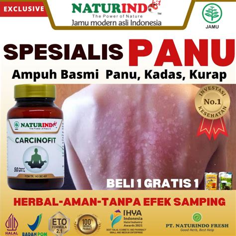 Jual Obat Penghilang Panu Kadas Kurap Menahun Kudis Exsim Panuan