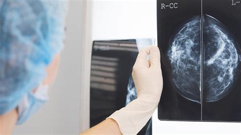 New Clinical Trials Hope To Improve Breast Cancer Detection In Women