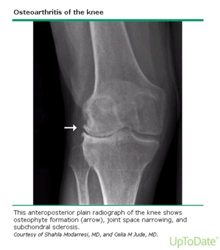 MSK Radiology Flashcards Quizlet