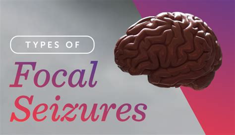 Types Of Focal Seizures Myepilepsyteam