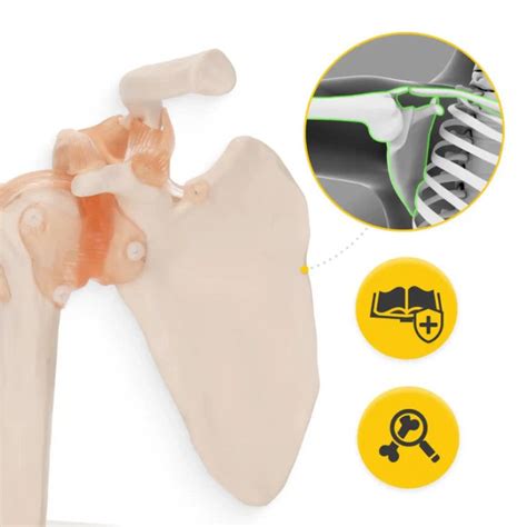 Fizjo Model Anatomiczny Stawu Barkowego Z Wi Zad Ami D Skala