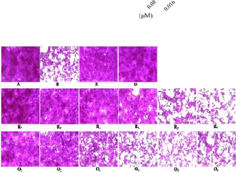 Morphological Analysis Of Mdck Cells After Infection With Influenza