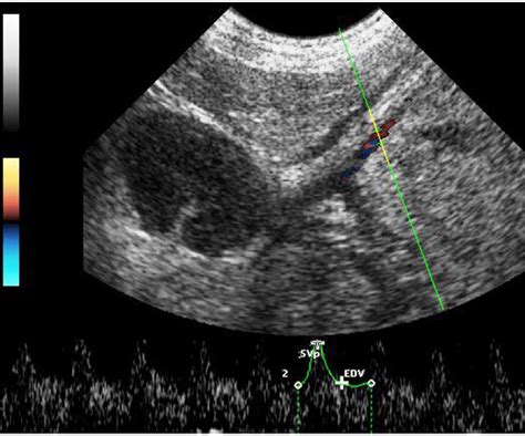 Scielo Brasil Conventional And Doppler Ultrasonography On A Goat