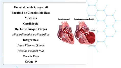 Resúmenes De Miocardiopatías Descarga Apuntes De Miocardiopatías