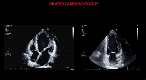 Haiku Echo 04 Cardiac Imaging Agorà