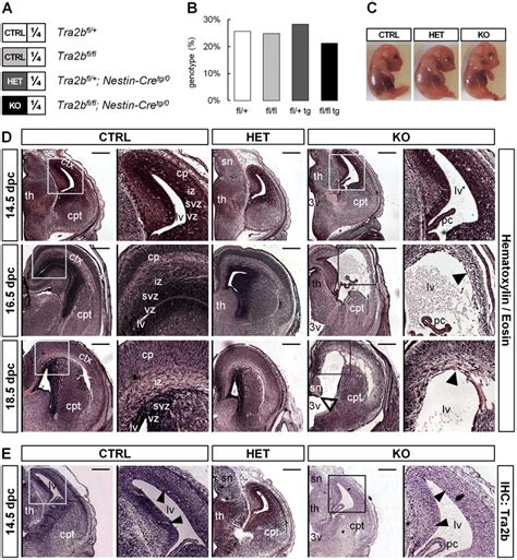 Conditional Ablation Of Tra B Causes Perinatal Lethality And Disturbed