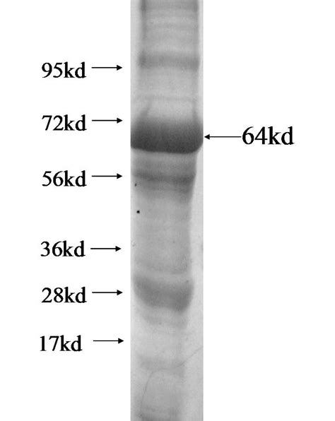 NCLN Fusion Protein Ag13318 Proteintech