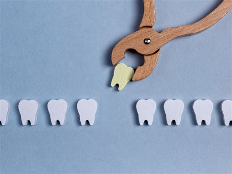 Understanding Tooth Loss: Causes, Impact, and Modern Solutions - Dent Ally