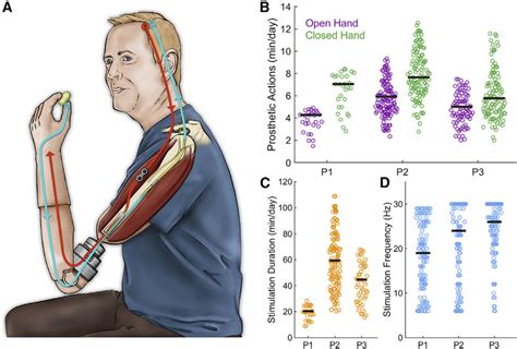 Neuromusculoskeletal Prosthesis Used In Daily Life A Participant