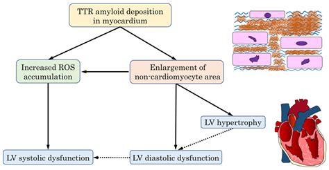 Jpm Free Full Text Transthyretin Amyloid Cardiomyopathy Impact Of Transthyretin Amyloid