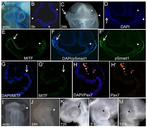 The surface ectoderm is required for RPE specification in the chick ... 