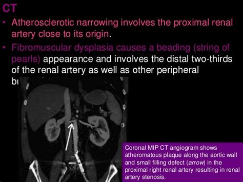 2 abdomen pathology ct