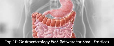 Top 10 Gastroenterology Emr Software For Small Practices