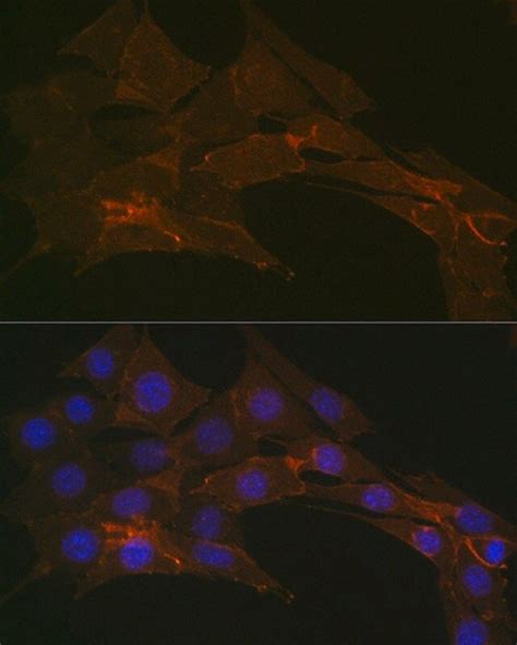 Anti Na K ATPase Antibody Produced In Rabbit