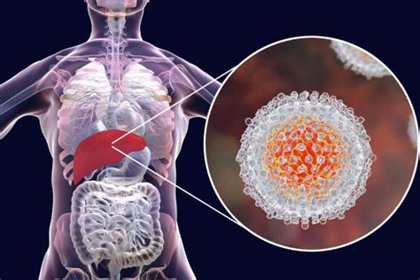 9 Ways Chronic Hepatitis C Can Affect Your Body