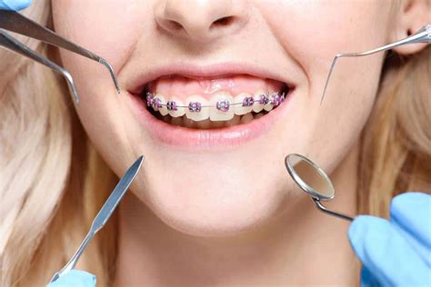 What Is Orthodontics A Complete Guide Thompson Creek Dental