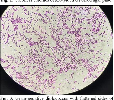 Figure 3 from MOLECULAR DETECTION OF KLEBSIELLA OXYTOCA ISOLATED FROM ...