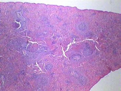 Spleen Histology - Spleen - histology slide