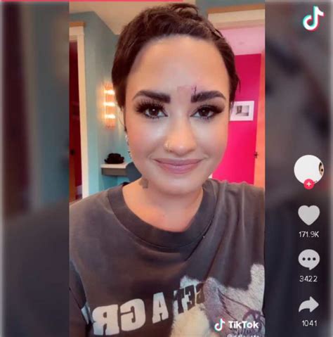 Foto Demi Lovato Muestra Cómo Quedó Su Frente Tras Sufrir Accidente