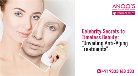 Souirensu It Works: The Celebrity Secret to [Desired Outcome] - pa7zczz