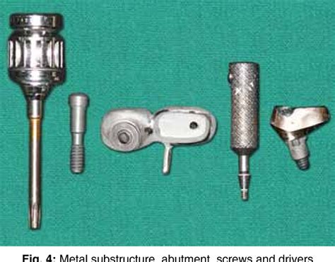 Management Of A Malpositioned Implant Using Custom Abutment And Screw