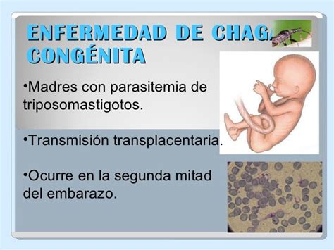 Presentacion Chagas