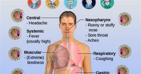 The Flu - Symptoms and Causes. | stomach flu symptoms