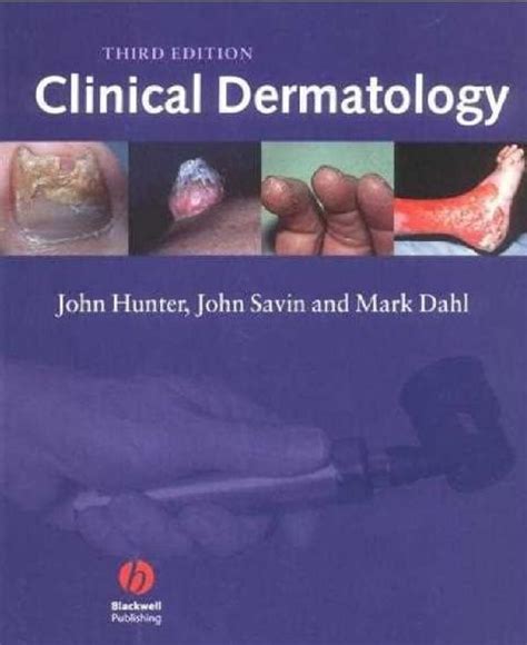 Clinical Dermatology