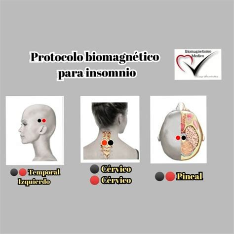 Stream Episode BIOMAGNETISMO Protocolo Para Reducir El Insonmio By