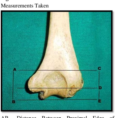 Figure 1 From Olecranon Fossa In Humeri Of North Indian Population Of