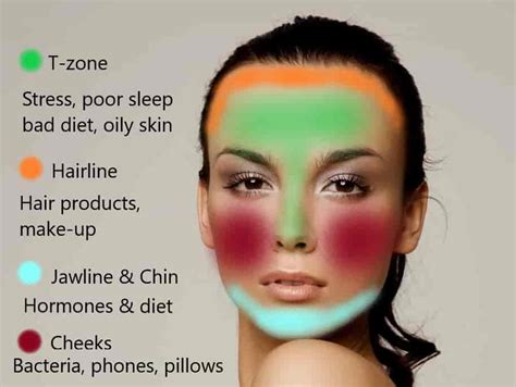 Acne Face Map: What Spots in Different Areas Mean