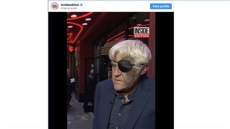 Jay Leno Shows Off Bruised Face After Falling 60 Feet Tri City Herald