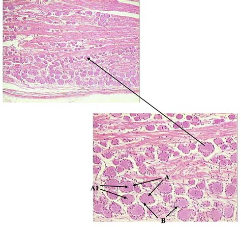 Nerve Tissue (Slide 75) Diagram | Quizlet