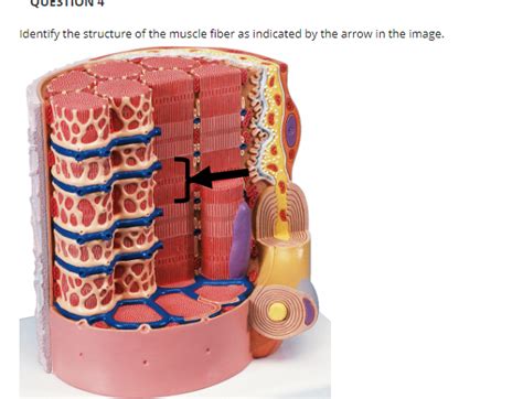 Answered Identify The Structure Of The Muscle Bartleby