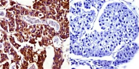 Prolactin R Antibody T6 Azide And BSA Free Novus Biologicals 0