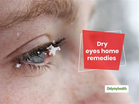 Natural Remedies And Prevention Tips For Dry Eyes | OnlyMyHealth