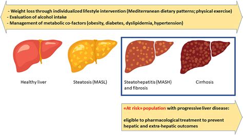 Dietary And Pharmacological Treatment In Patients With Metabolic Dysfunction Associated