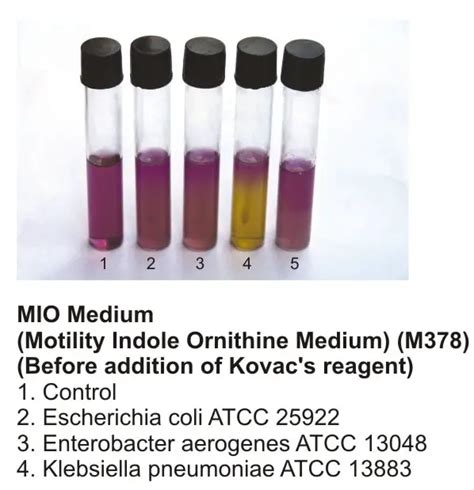 Motility Tests For Bacteria Principles Procedures And Results