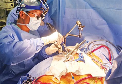 A Double Feat Minimally Invasive Double Valve Surgery Murmurs