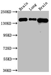 Anti Homo Sapiens Human FGFR2 Recombinant Monoclonal Antibody Cusabio